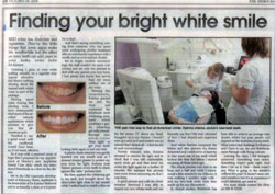 Finding your bright white smile