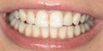 Seanan After
