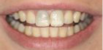 Seanan Before