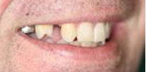 Paul Before
