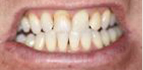 Brian Before